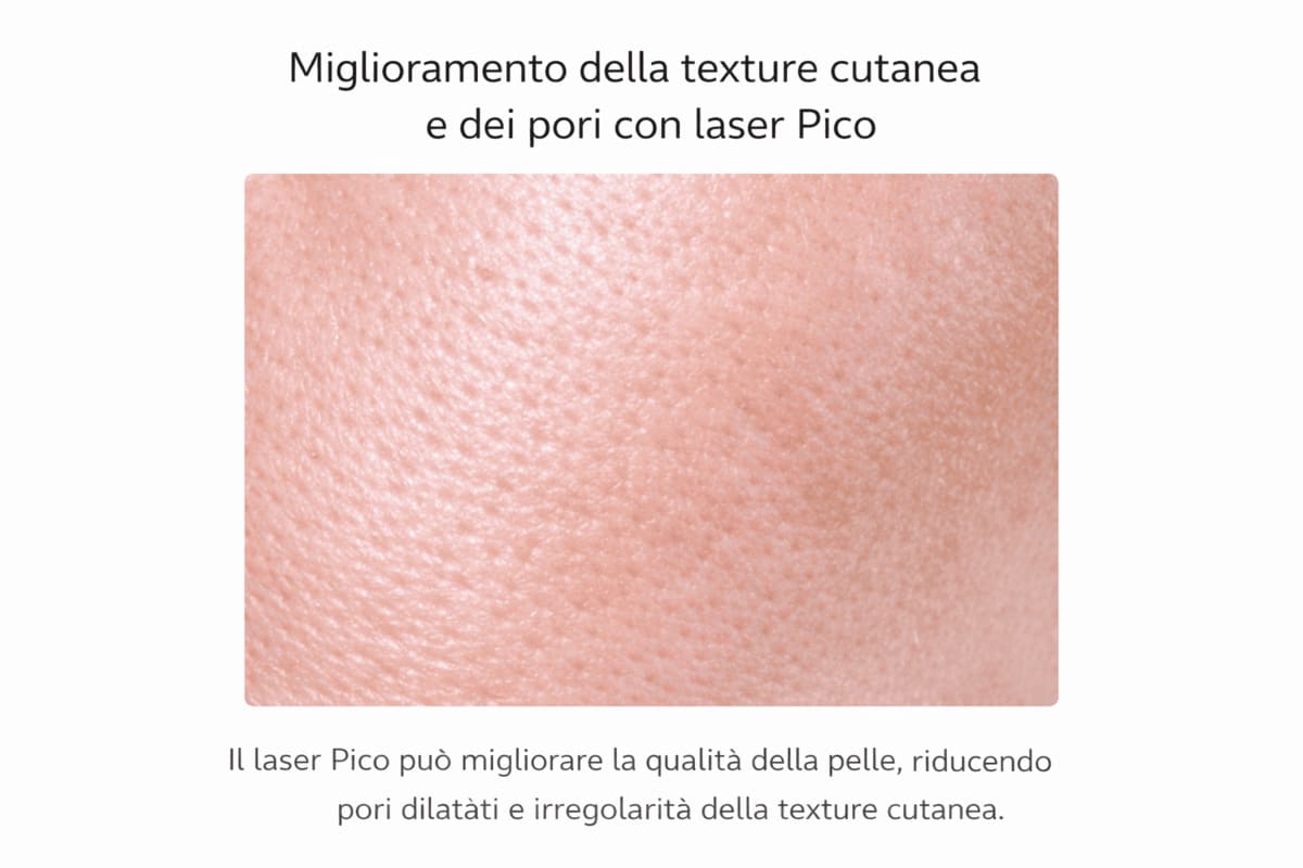 Miglioramento della texture cutanea e dei pori con laser Pico
