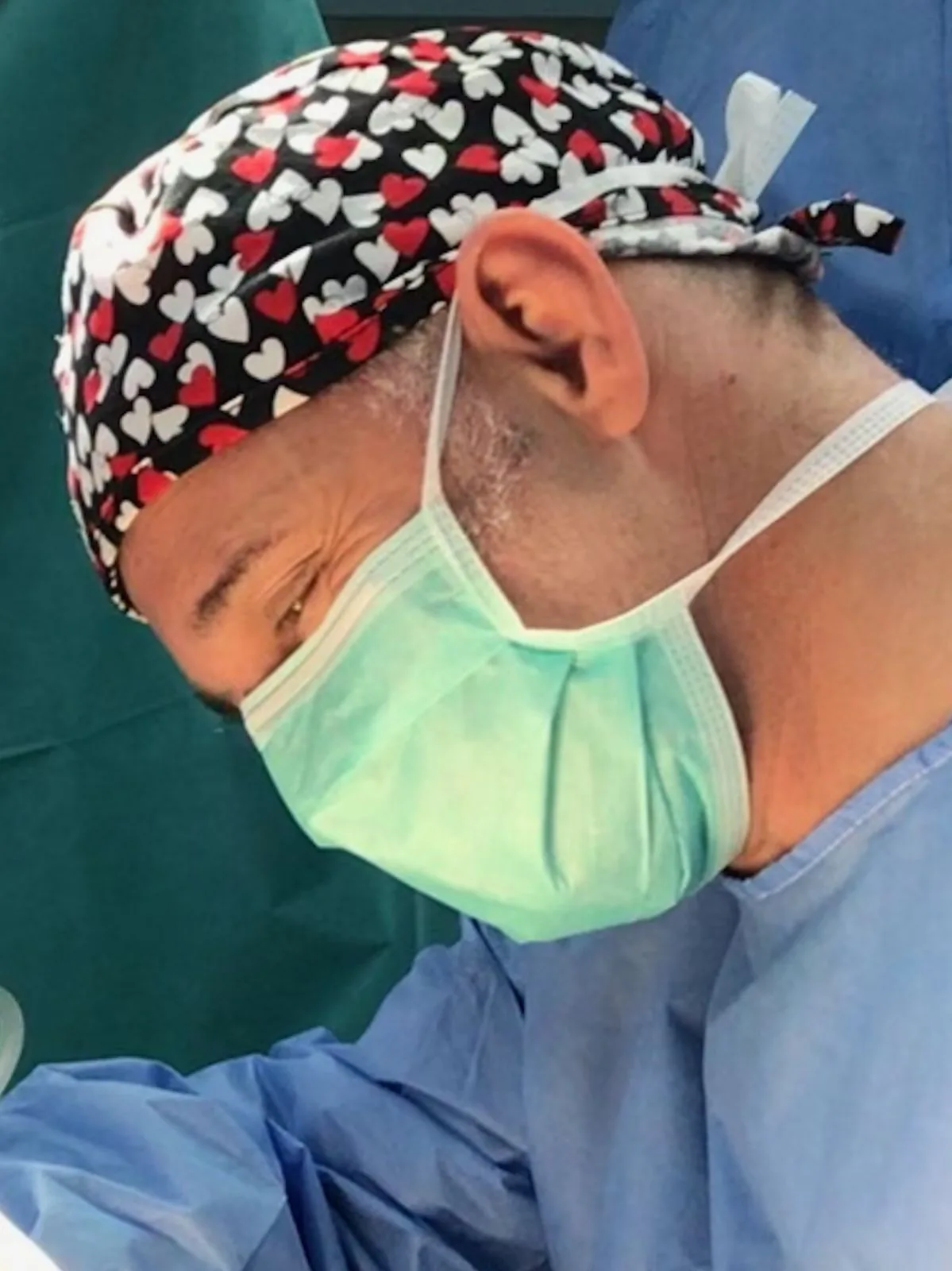lipofilling viso
